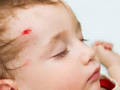 Chấn thương vùng đầu hoặc cột sống có thể ảnh hưởng đến hệ thần kinh của trẻ 